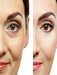 AGING SKIN right banner