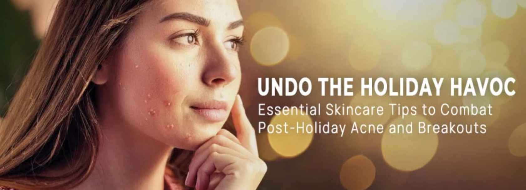 Undo the Holiday Havoc: Essential Skincare Tips to Combat Post-Holiday Acne and Breakouts Banner